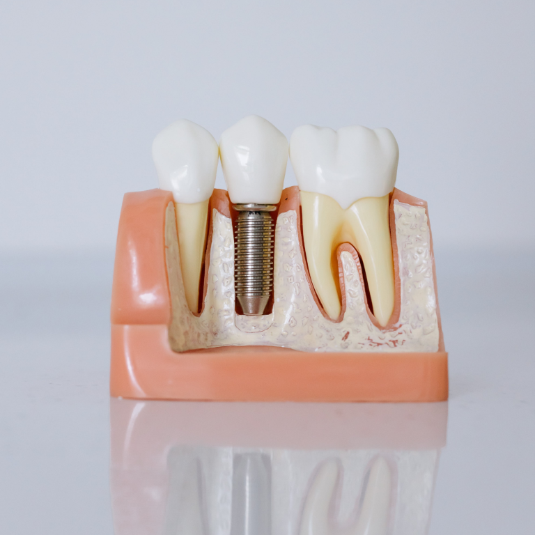 Próteses Dentárias